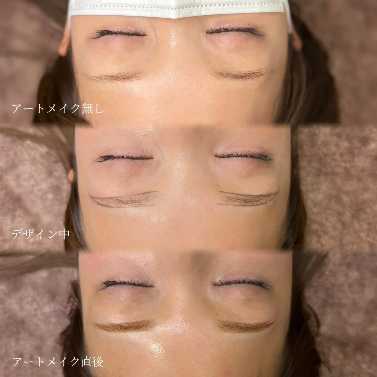 【Before / After】After photo taken 1 month later.