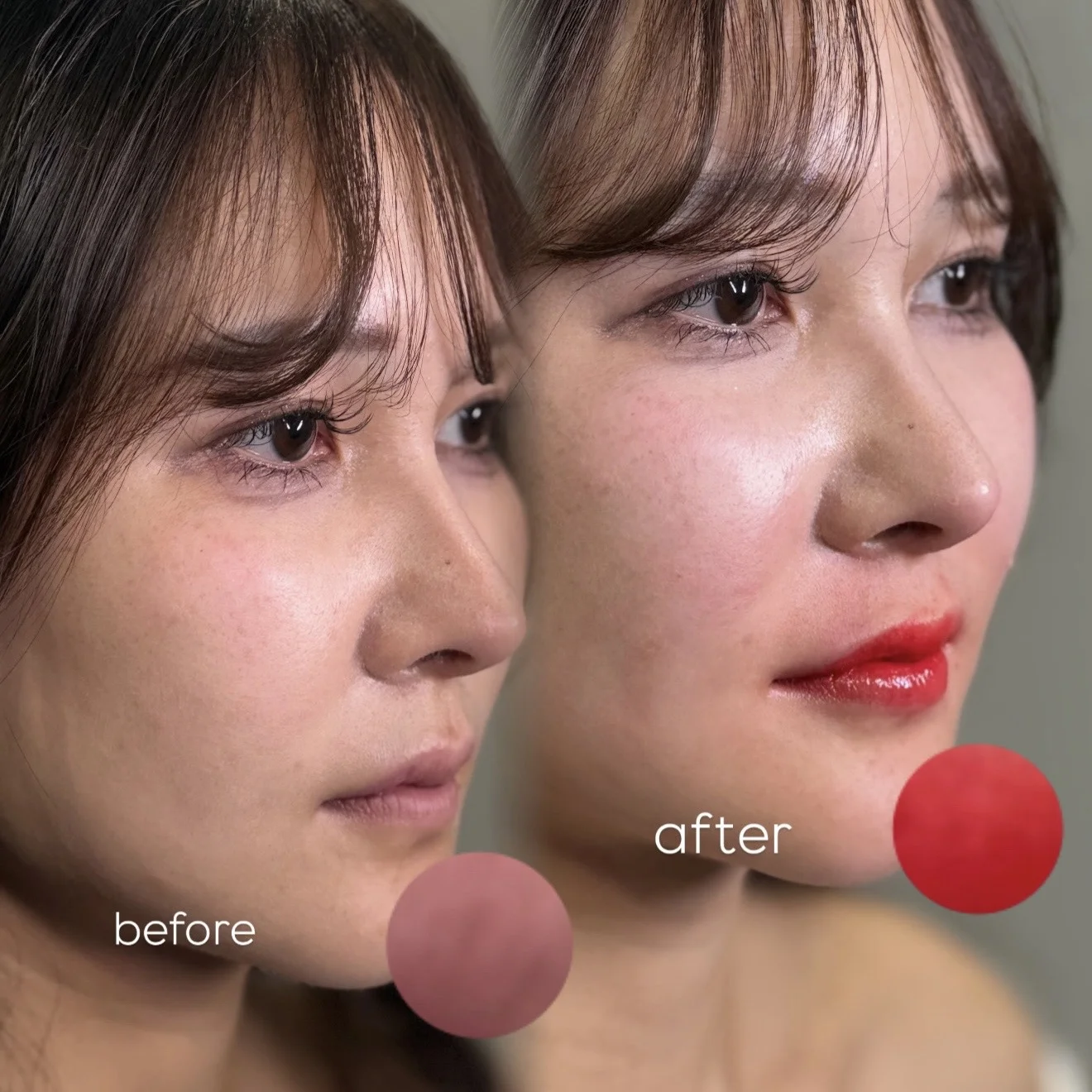 【Before / After】After photo taken 1 month later.