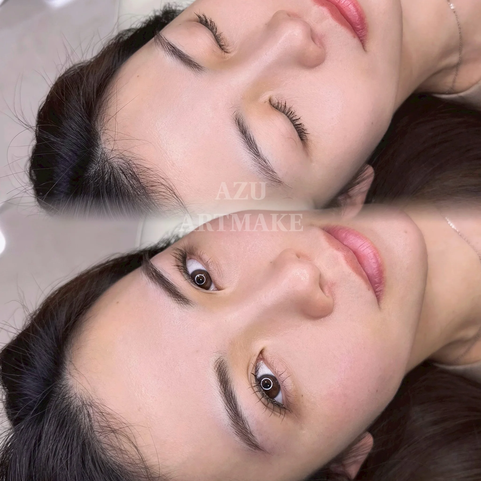 【Before / After】After photo taken 1 month later.